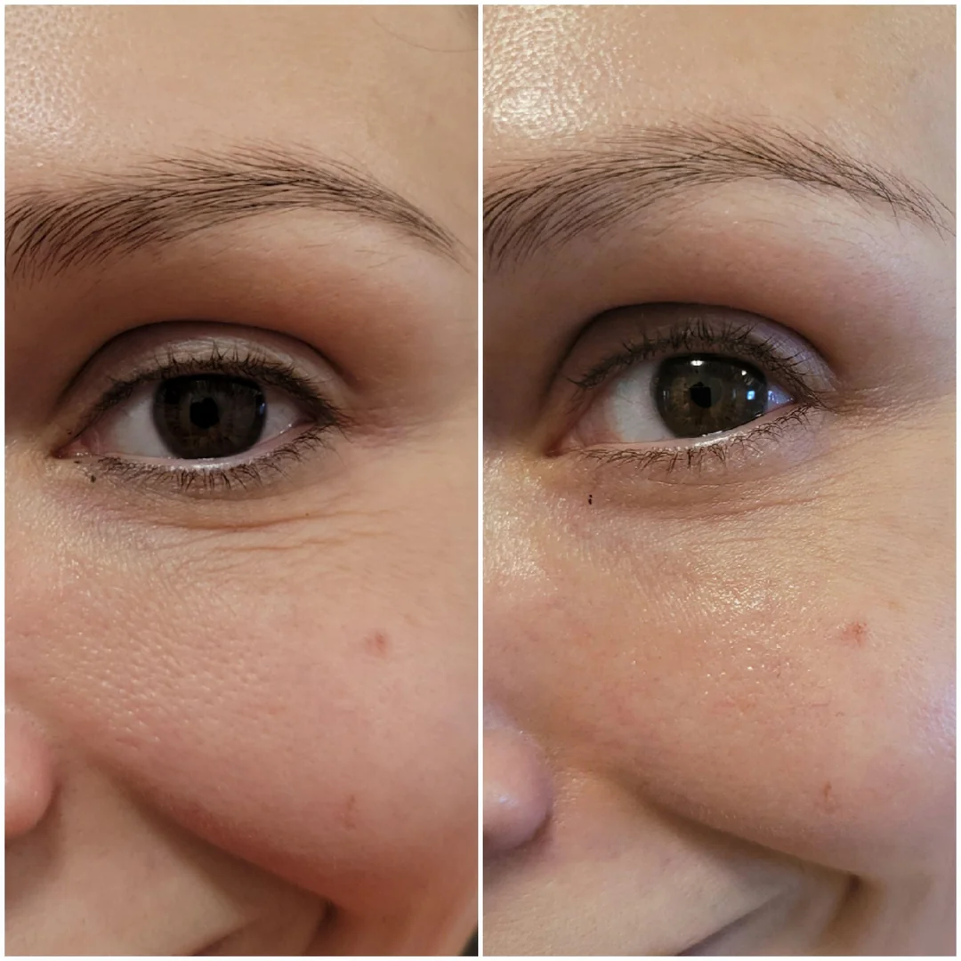 Square before and after under-eye skincare result
